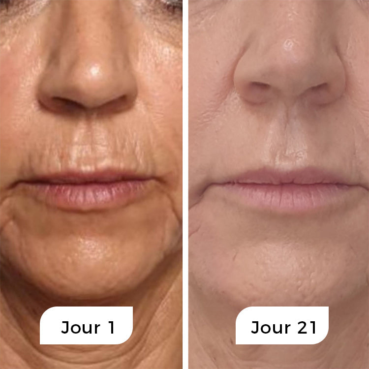 Subskrypcja Rejuven - Nocne serum przeciwstarzeniowe