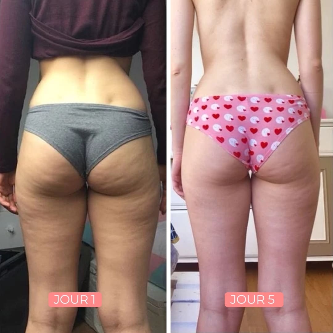 B-Smooth Lift & Firm Booty Cream