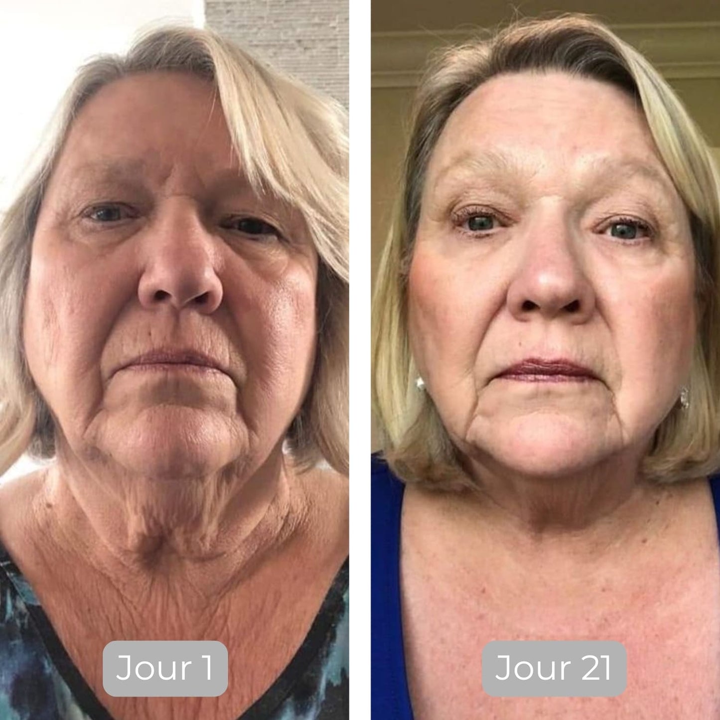 Luminate – Serum do twarzy z witaminą C