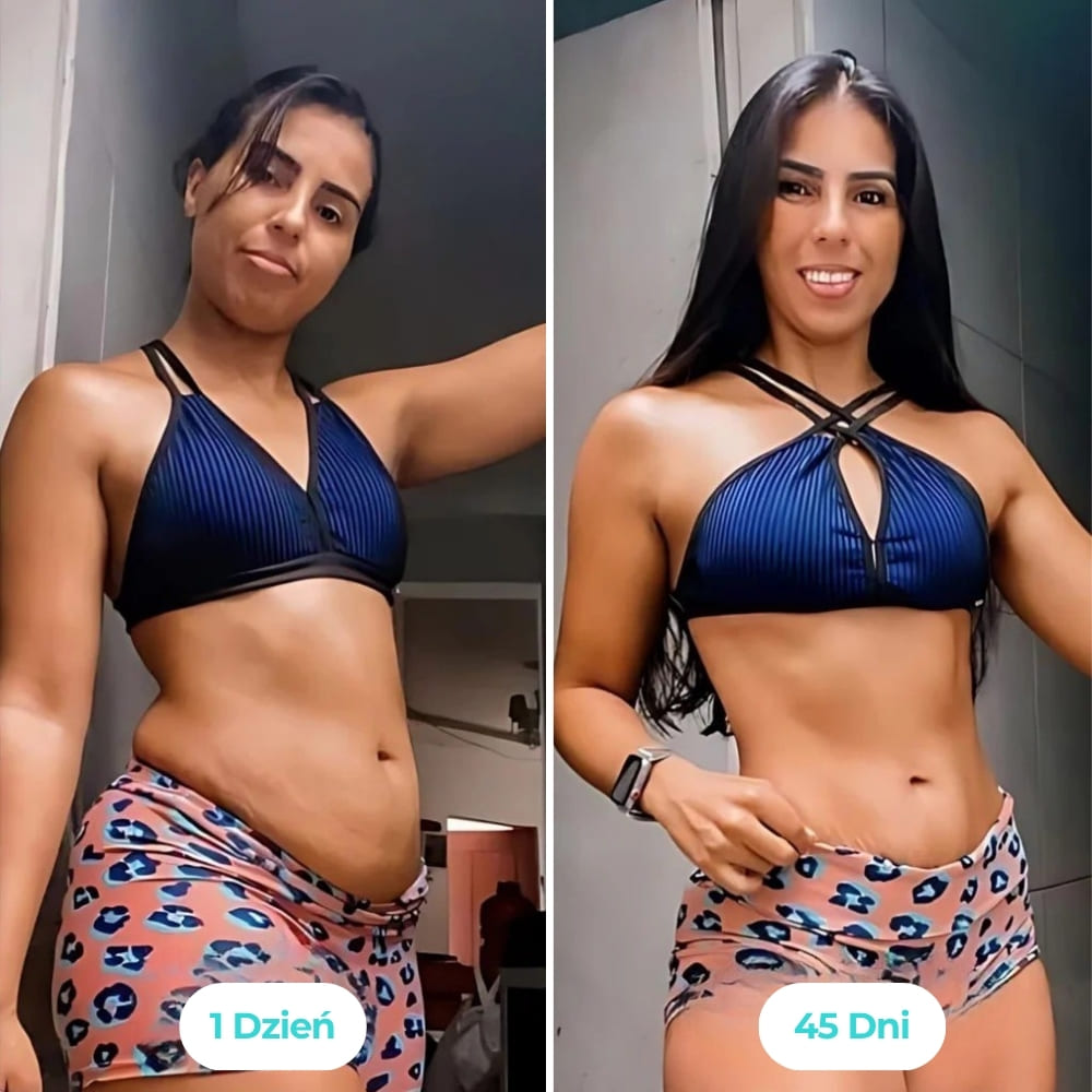 Vibraskin® - Poprawia wygląd skóry